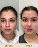 Confidence - Clarifying Night Face Gel for Combination, Oily, Acne-prone skin