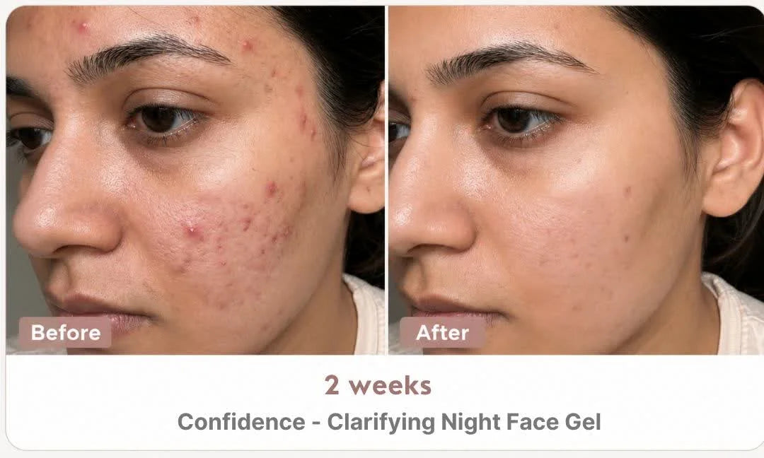 Before and after — Pigmentation results in 4 weeks