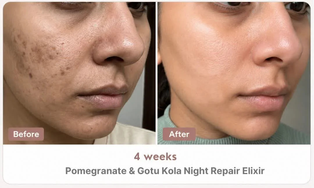 Before and after — Dull Skin results in 6 weeks